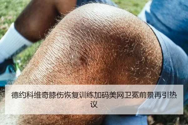 德约科维奇膝伤恢复训练加码美网卫冕前景再引热议